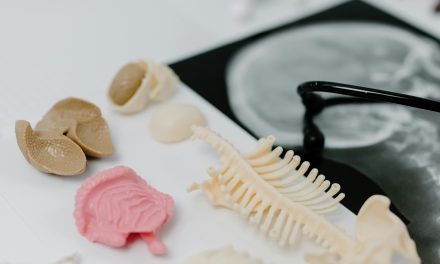 Worried about your bone health? Here’s what a bone density test reveals