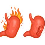 Stop heartburn from ruining your day: tips for fast relief