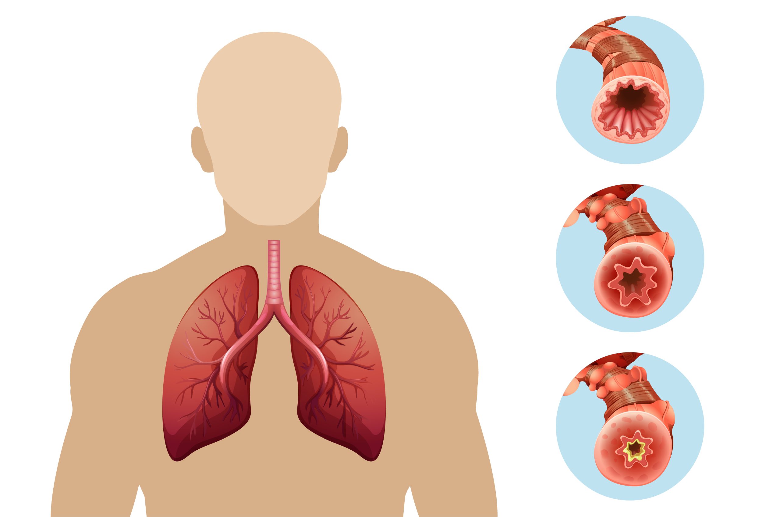 Learn about pulmonary hypertension