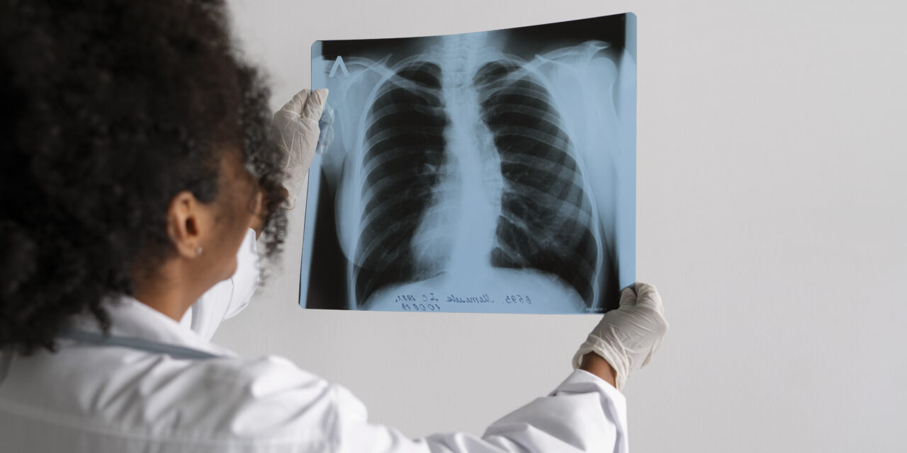 Testing for tuberculosis (TB)