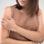Simple solutions to manage chronic eczema