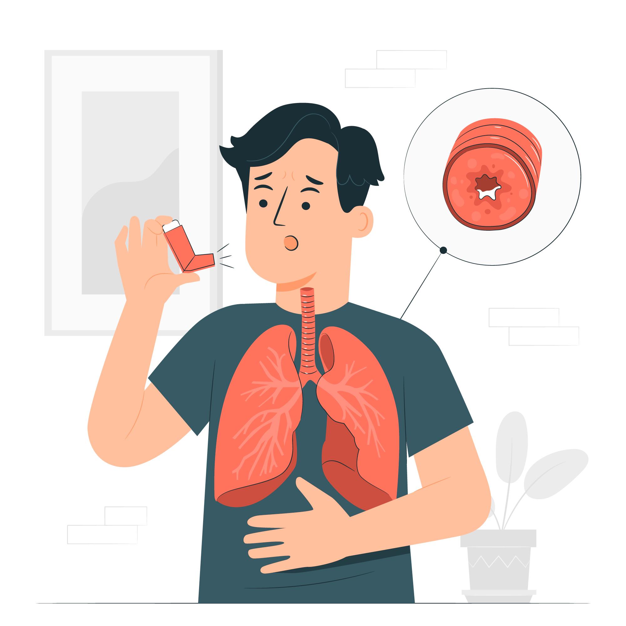 Managing asthma symptoms